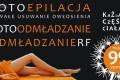 Depilacja laserowa, fotoepilacja